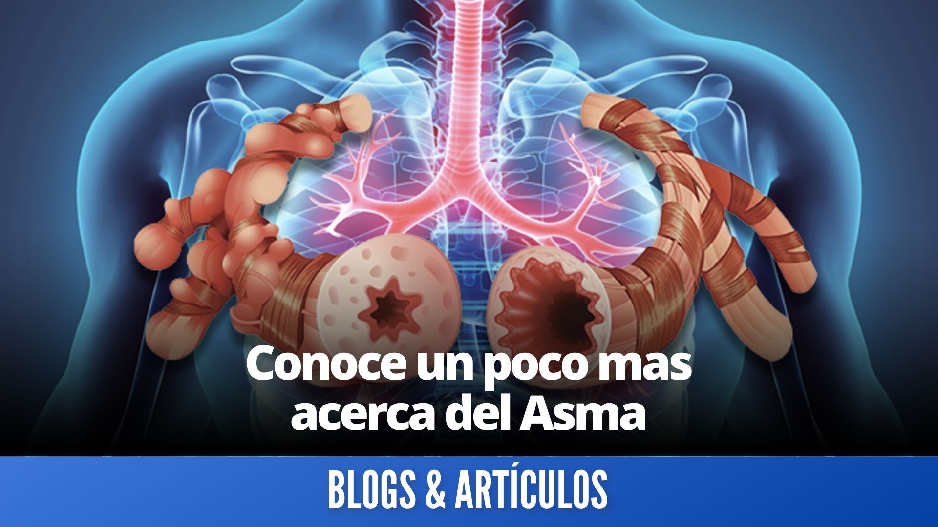 conoce-un-poco-mas-acerca-del-asma